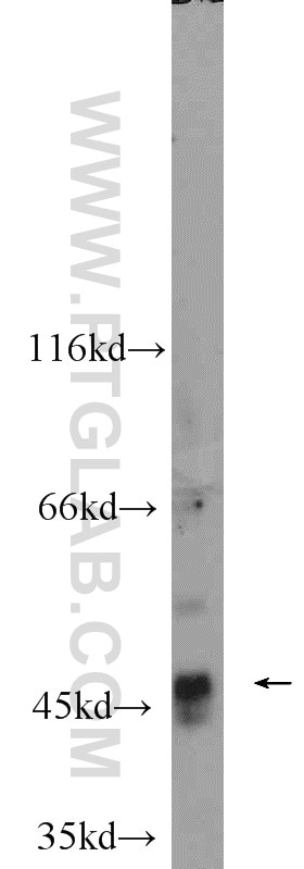 WB analysis of MCF-7 using 22858-1-AP