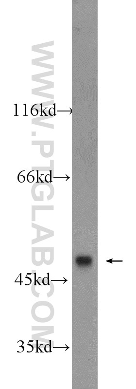 Western Blot (WB) analysis of HEK-293 cells using BMP10 Polyclonal antibody (22858-1-AP)