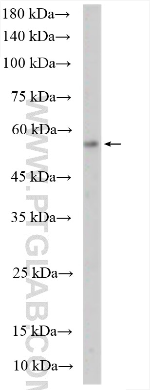 Western Blot (WB) analysis of HeLa cells using BMP15 Polyclonal antibody (18982-1-AP)