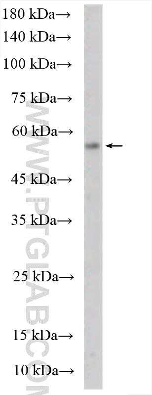 WB analysis of HeLa using 18982-1-AP