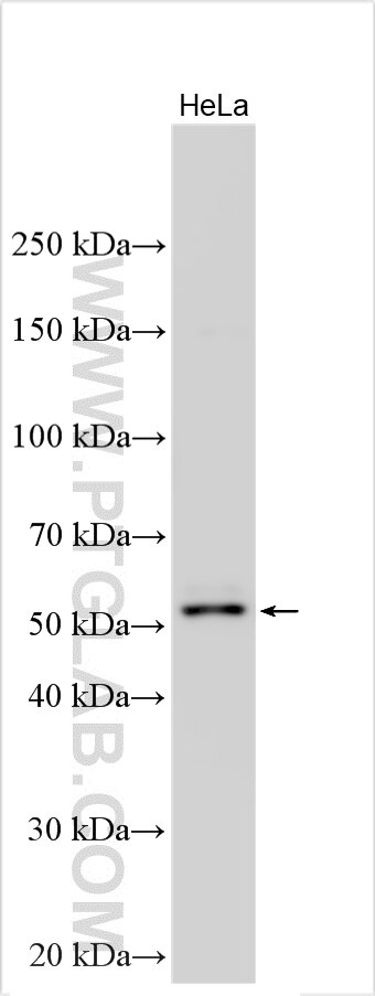 Western Blot (WB) analysis of various lysates using BMP15 Polyclonal antibody (32721-1-AP)