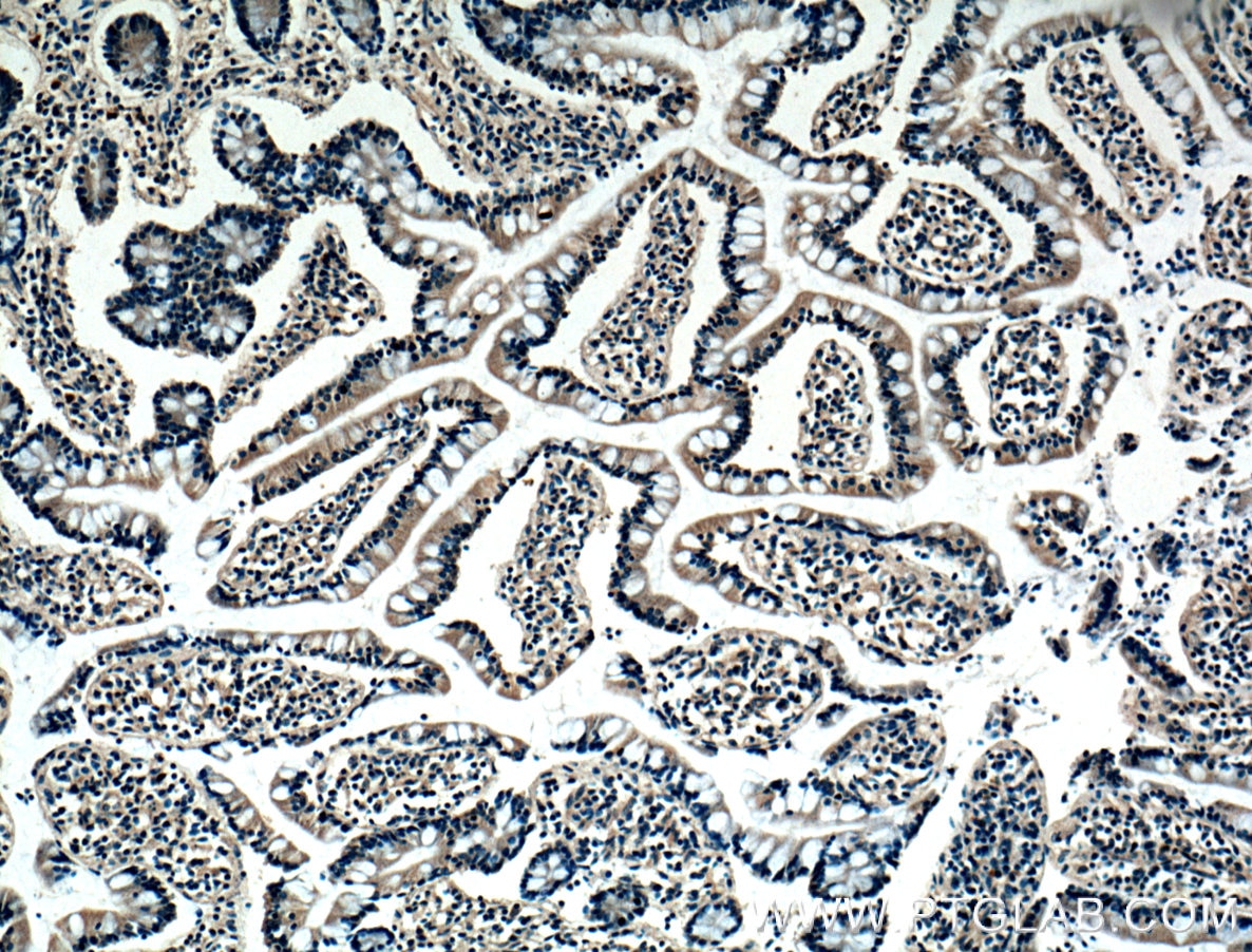 Immunohistochemistry (IHC) staining of human small intestine tissue using BMP2 Monoclonal antibody (66383-1-Ig)