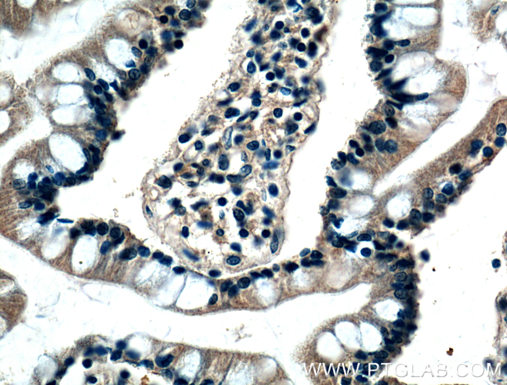 Immunohistochemistry (IHC) staining of human small intestine tissue using BMP2 Monoclonal antibody (66383-1-Ig)