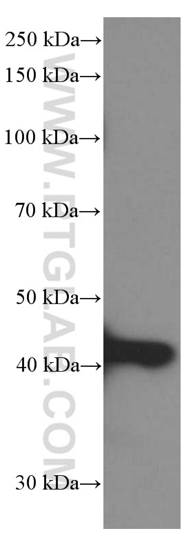 WB analysis of HeLa using 66383-1-Ig