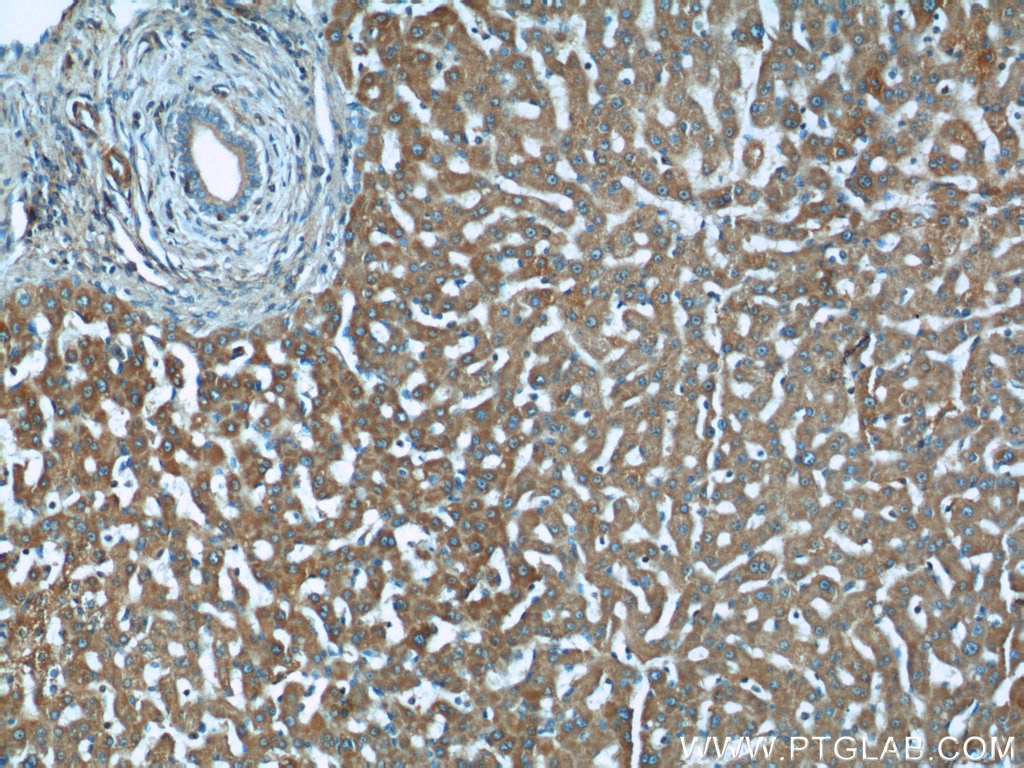 Immunohistochemistry (IHC) staining of human liver tissue using BMP3 Polyclonal antibody (22188-1-AP)