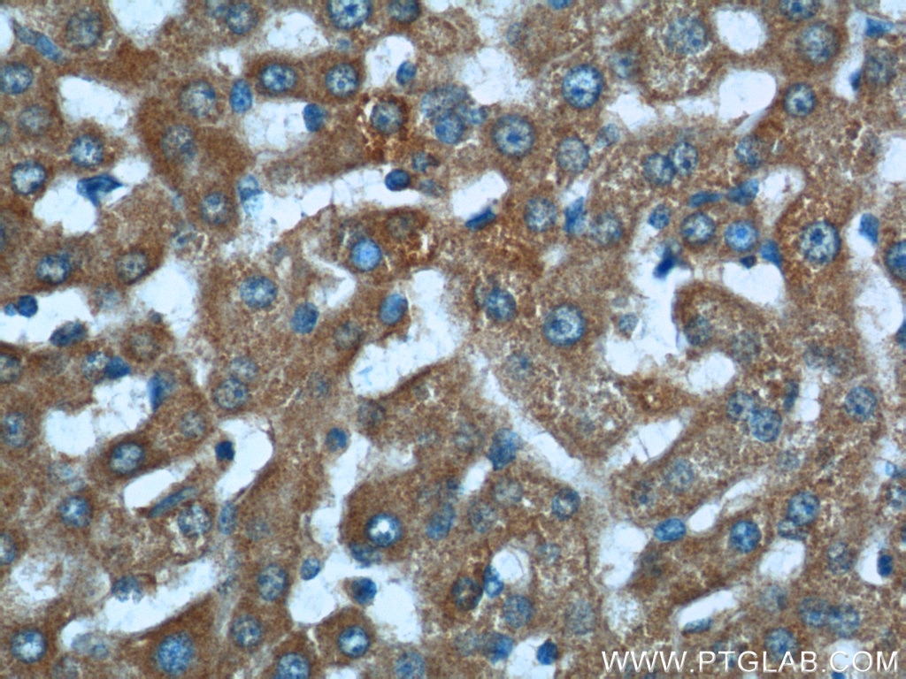 Immunohistochemistry (IHC) staining of human liver tissue using BMP3 Polyclonal antibody (22188-1-AP)