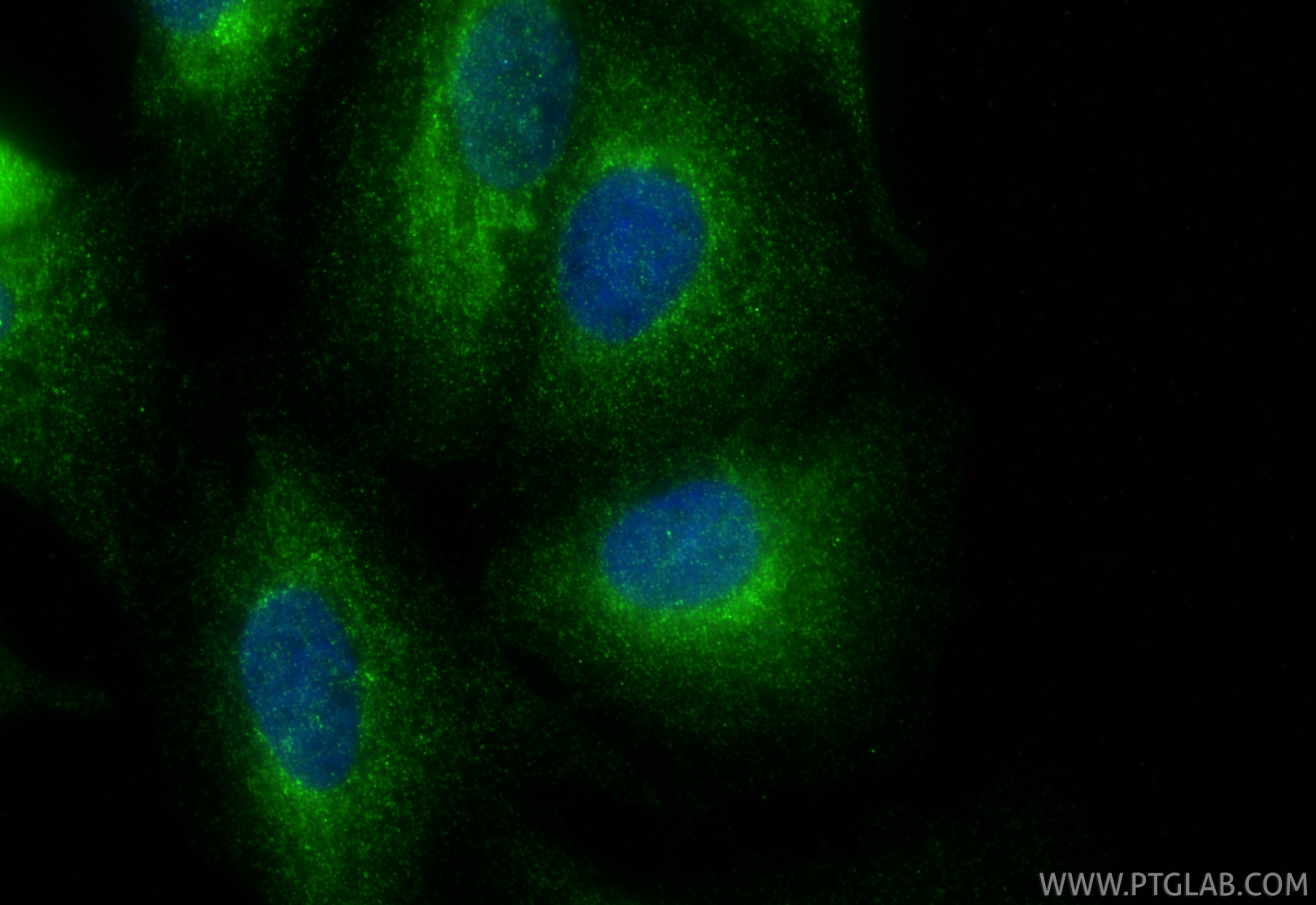 Immunofluorescence (IF) / fluorescent staining of A549 cells using BMP4 Polyclonal antibody (12492-1-AP)