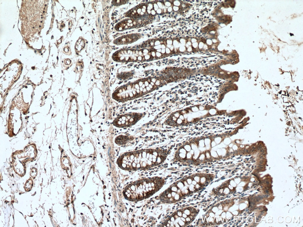 Immunohistochemistry (IHC) staining of human colon tissue using BMP5 Polyclonal antibody (13253-1-AP)