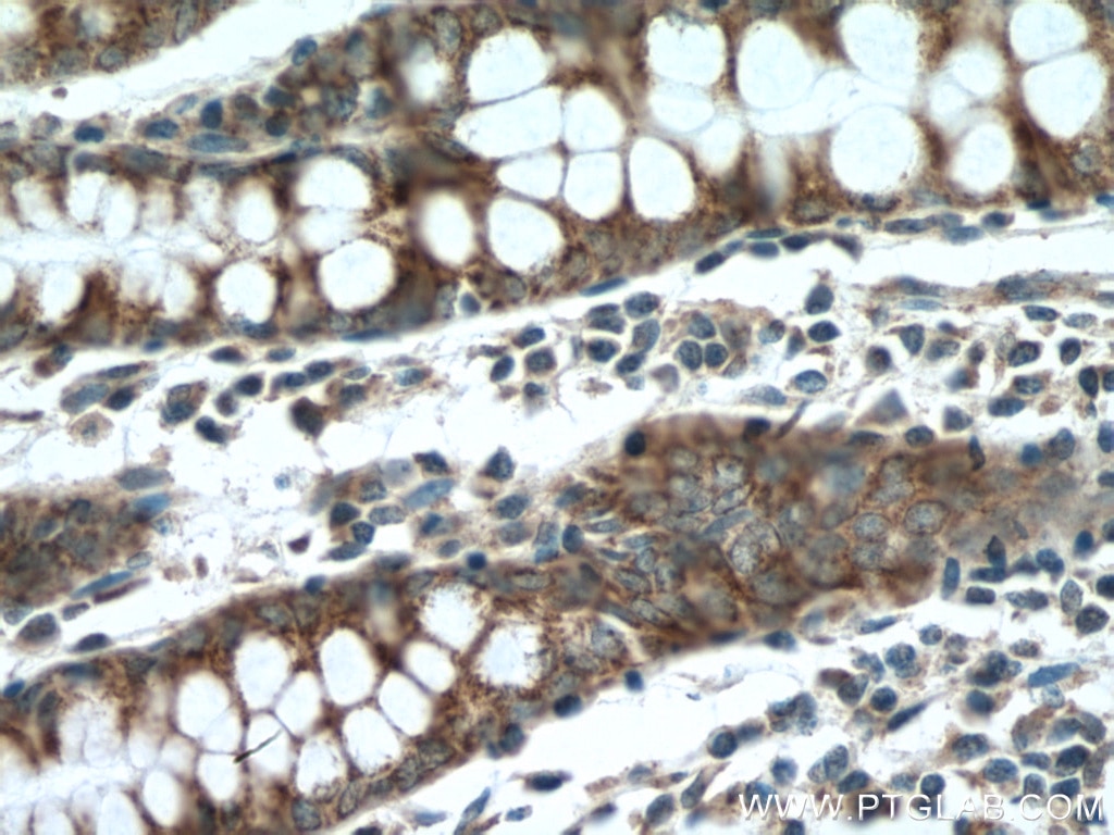 Immunohistochemistry (IHC) staining of human colon tissue using BMP5 Polyclonal antibody (13253-1-AP)