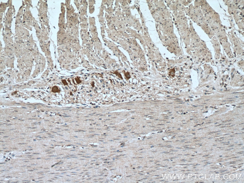 Immunohistochemistry (IHC) staining of human colon tissue using BMP5 Polyclonal antibody (13253-1-AP)