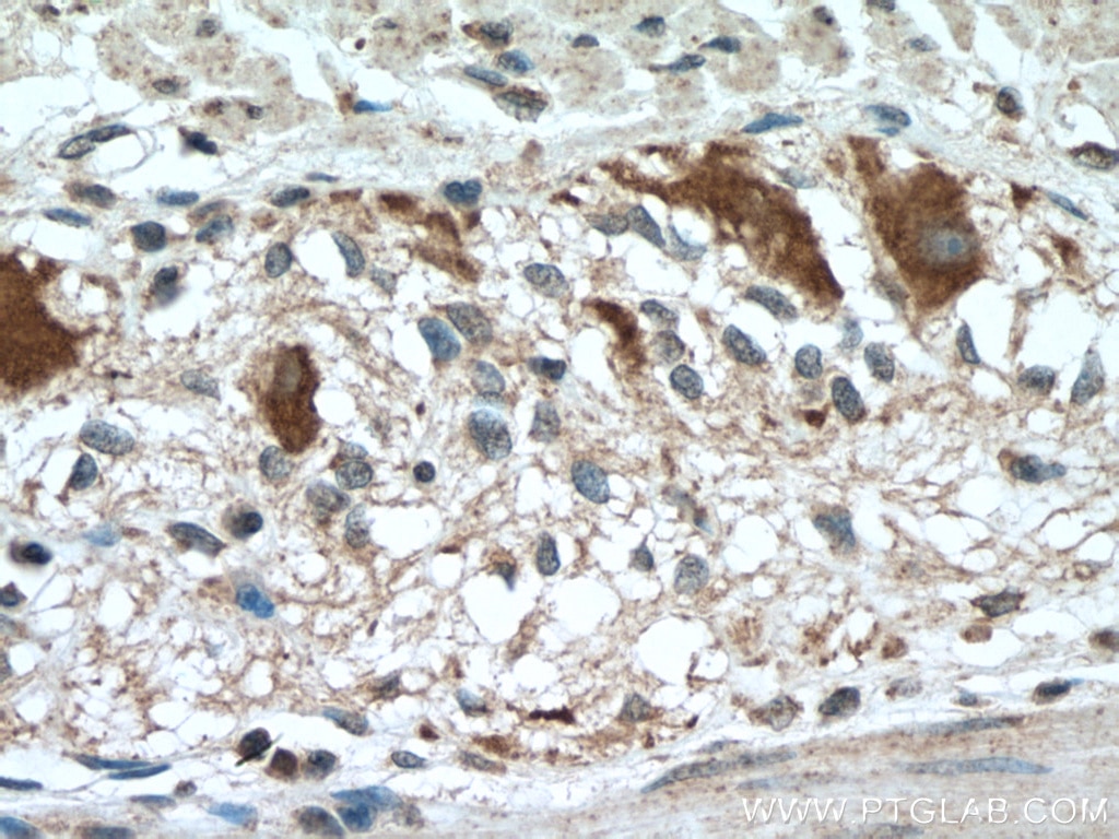 Immunohistochemistry (IHC) staining of human colon tissue using BMP5 Polyclonal antibody (13253-1-AP)