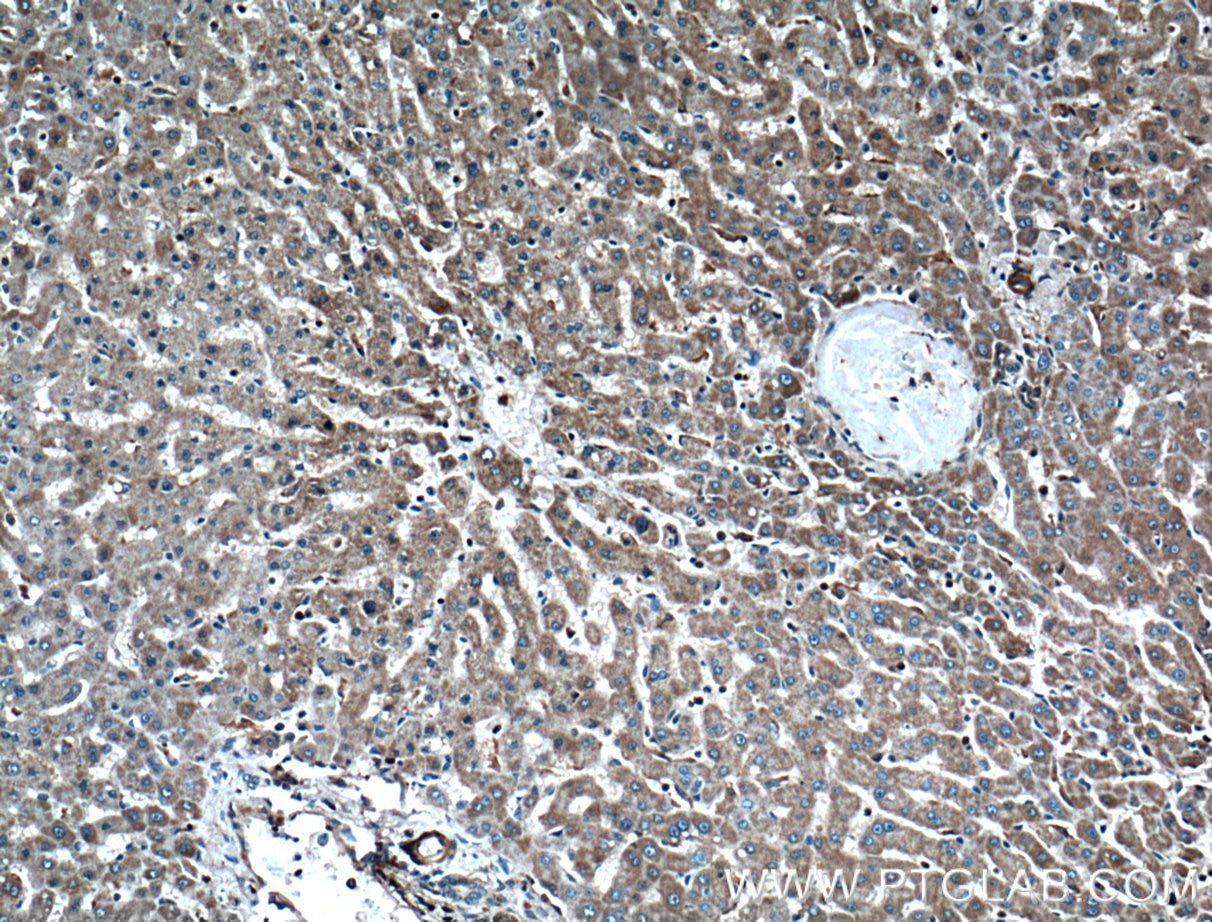 Immunohistochemistry (IHC) staining of human liver tissue using BMP6 Polyclonal antibody (55421-1-AP)