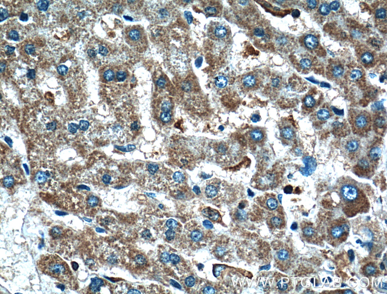 IHC staining of human liver using 55421-1-AP