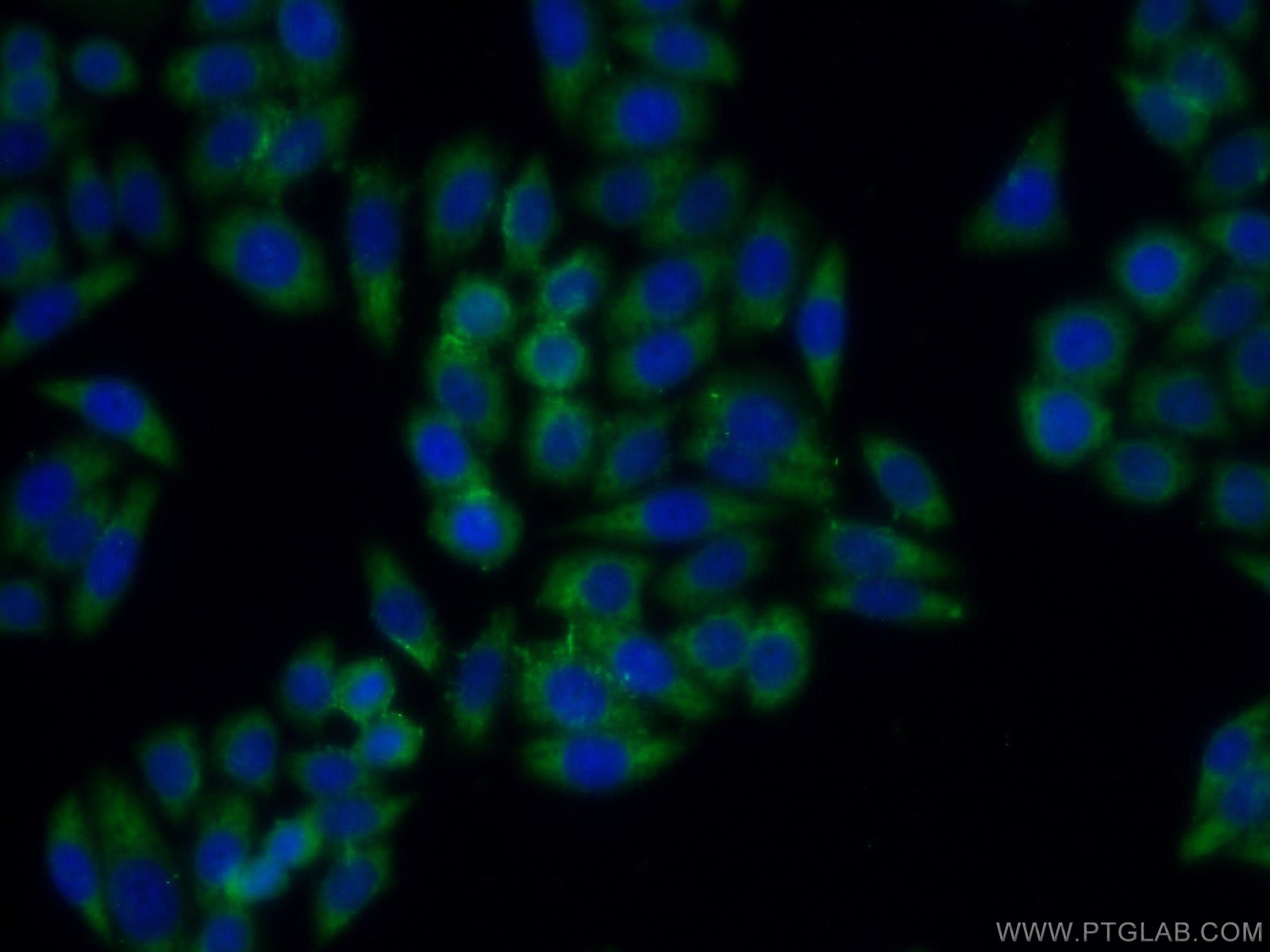 IF Staining of HeLa using 12221-1-AP