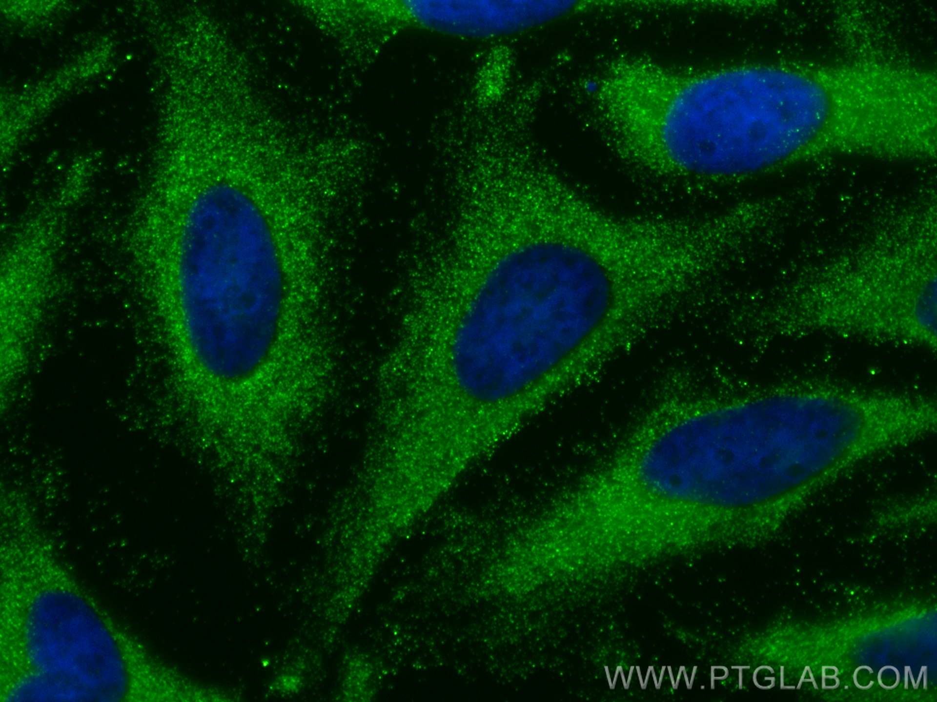 Immunofluorescence (IF) / fluorescent staining of HeLa cells using BMP7 Polyclonal antibody (12221-1-AP)