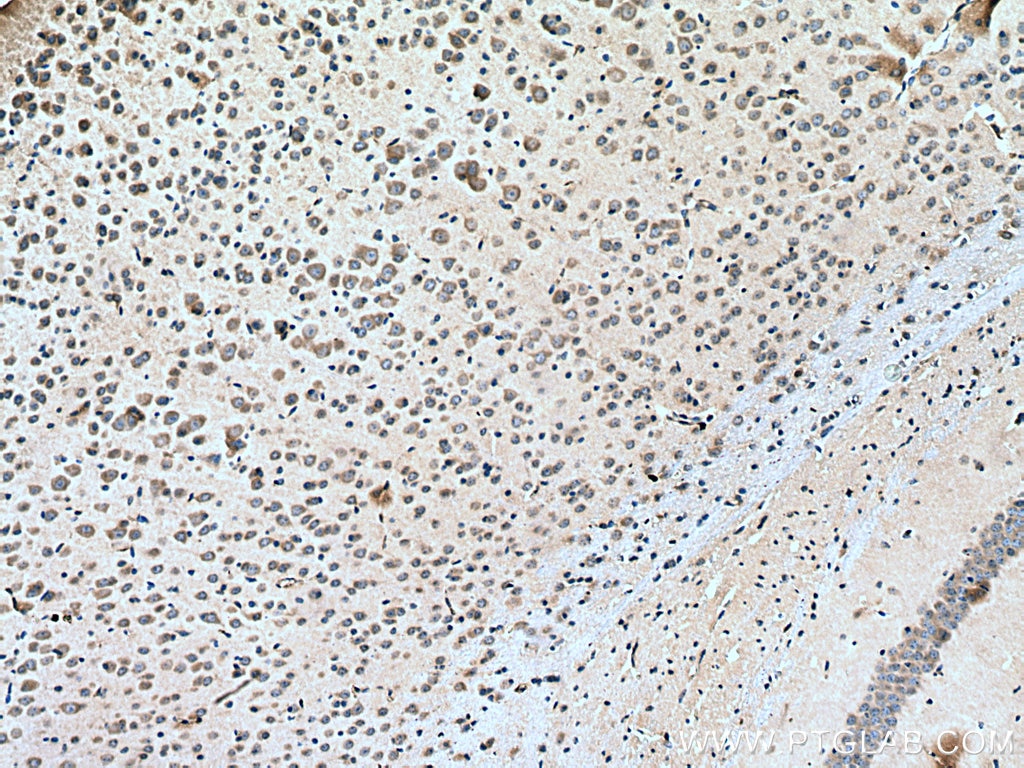 Immunohistochemistry (IHC) staining of mouse brain tissue using BMP7 Polyclonal antibody (12221-1-AP)
