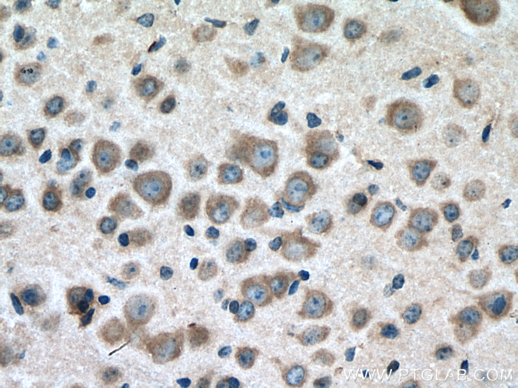 Immunohistochemistry (IHC) staining of mouse brain tissue using BMP7 Polyclonal antibody (12221-1-AP)