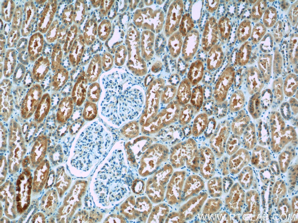 Immunohistochemistry (IHC) staining of human kidney tissue using BMP7 Polyclonal antibody (12221-1-AP)