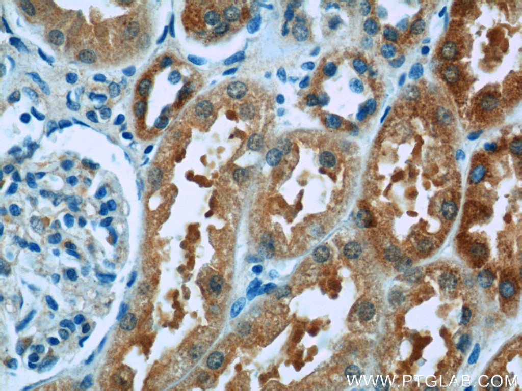 Immunohistochemistry (IHC) staining of human kidney tissue using BMP7 Polyclonal antibody (12221-1-AP)