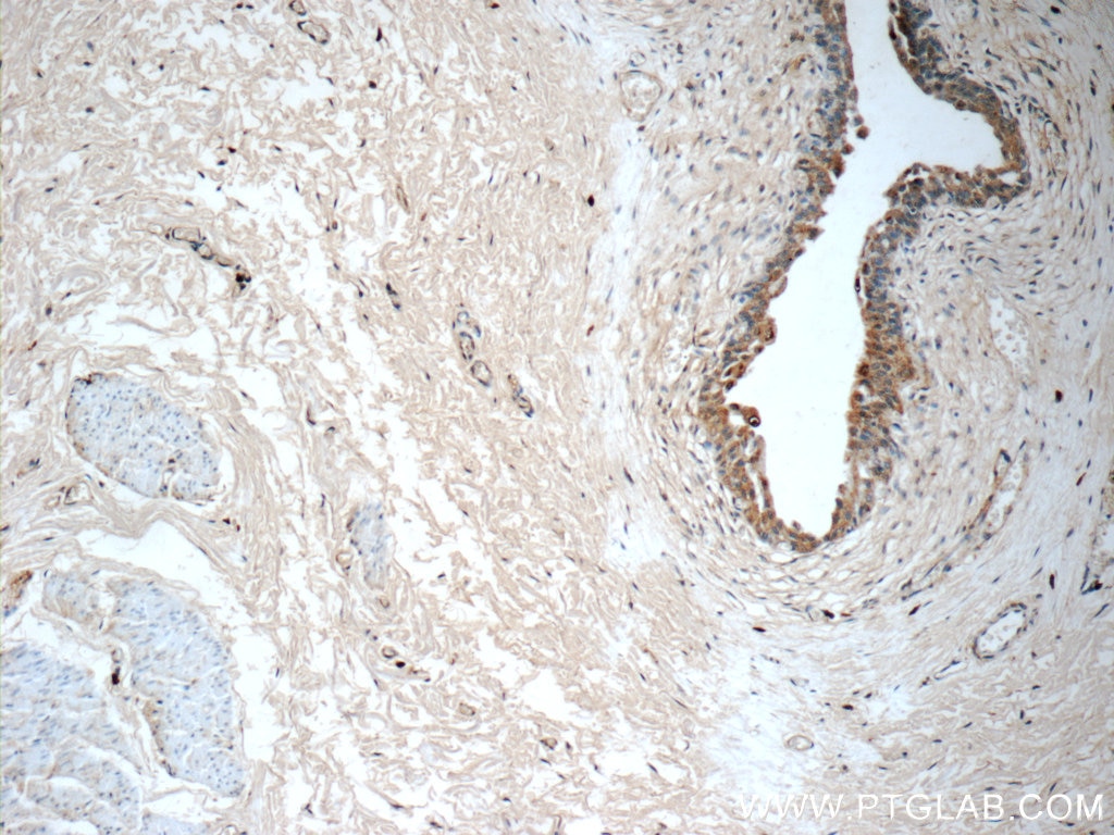 Immunohistochemistry (IHC) staining of human bladder tissue using BMP7 Polyclonal antibody (12221-1-AP)