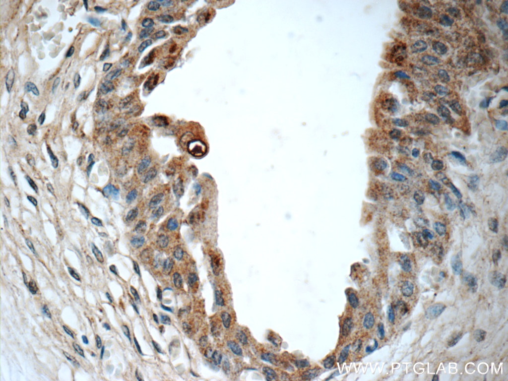 Immunohistochemistry (IHC) staining of human bladder tissue using BMP7 Polyclonal antibody (12221-1-AP)
