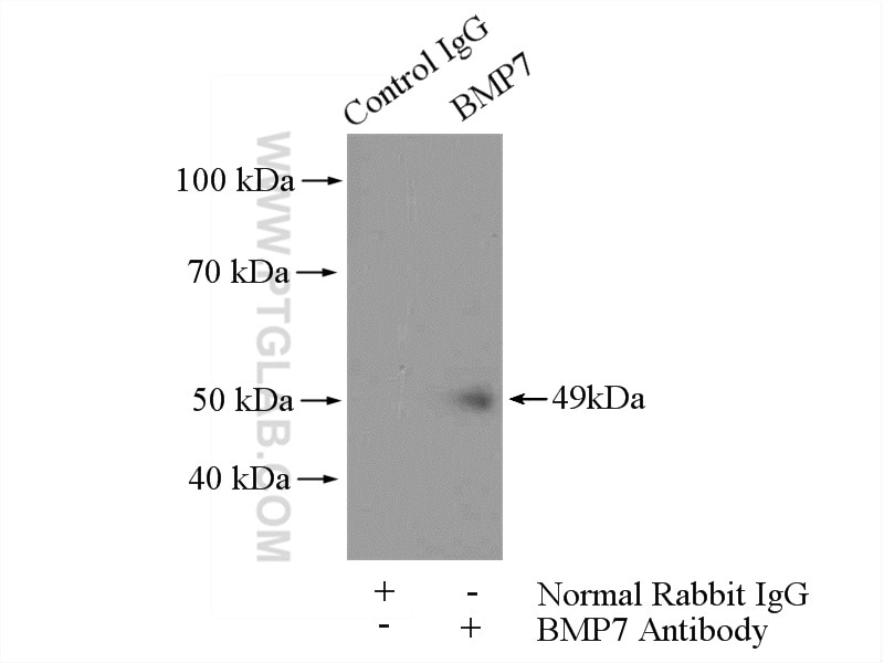 Immunoprecipitation (IP) experiment of HEK-293 cells using BMP7 Polyclonal antibody (12221-1-AP)