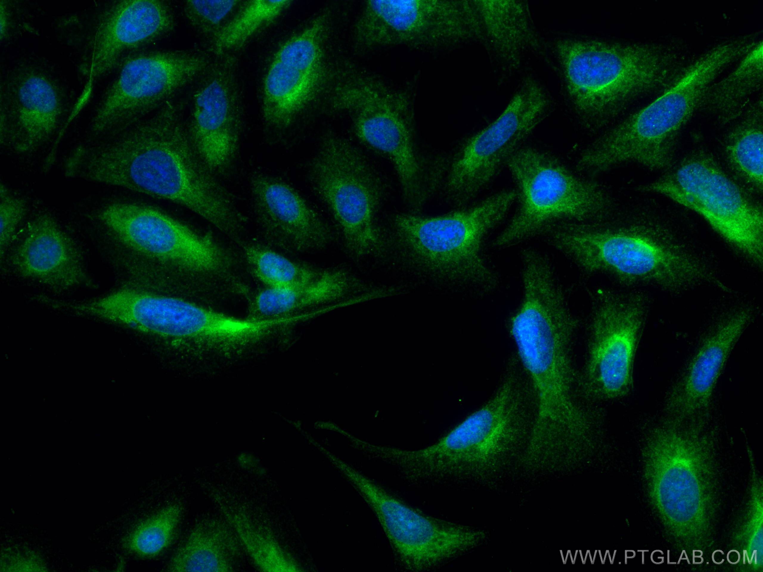 Immunofluorescence (IF) / fluorescent staining of U2OS cells using BMPR1A Polyclonal antibody (12702-1-AP)