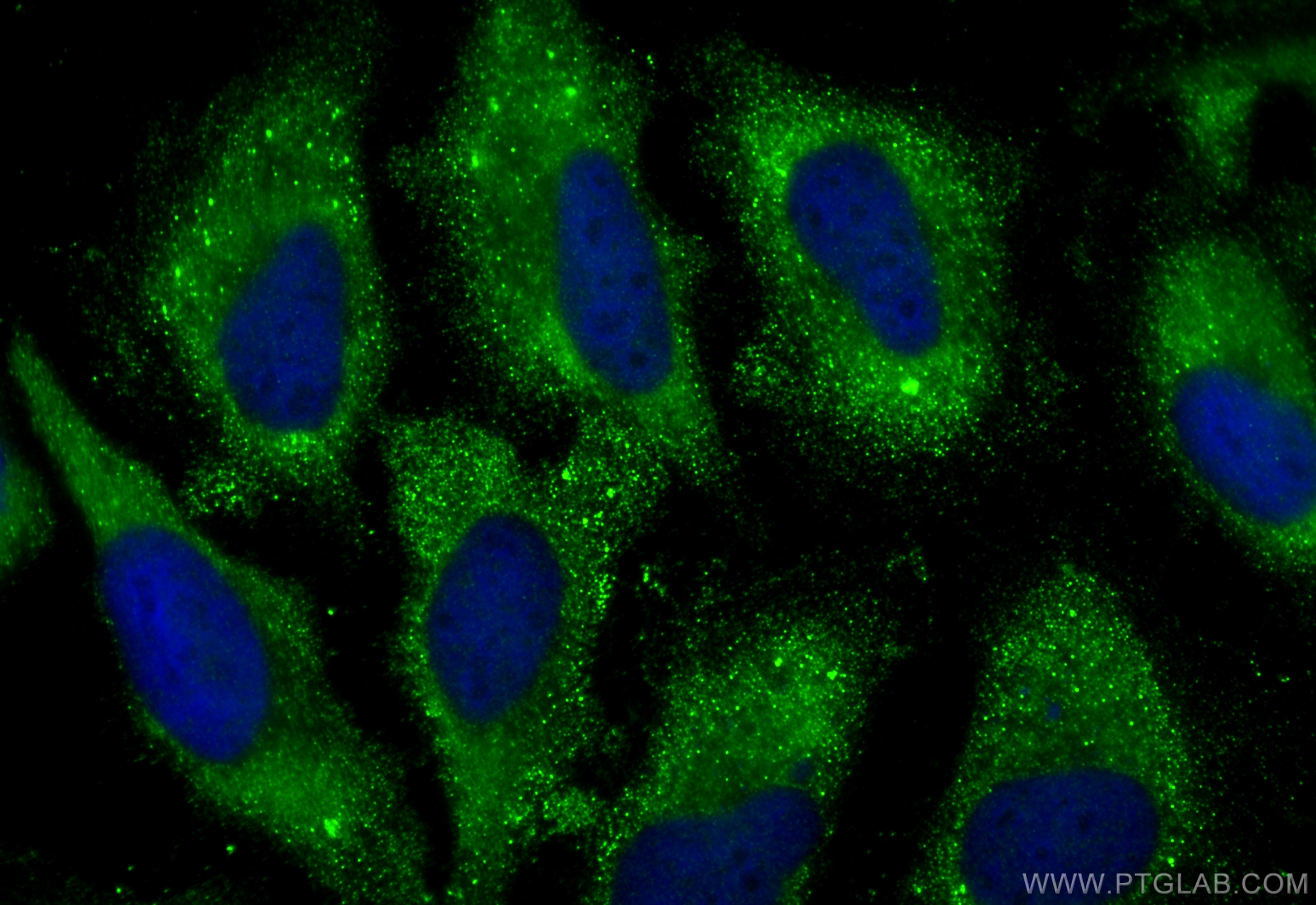 Immunofluorescence (IF) / fluorescent staining of HeLa cells using BMPR1A Polyclonal antibody (12702-1-AP)