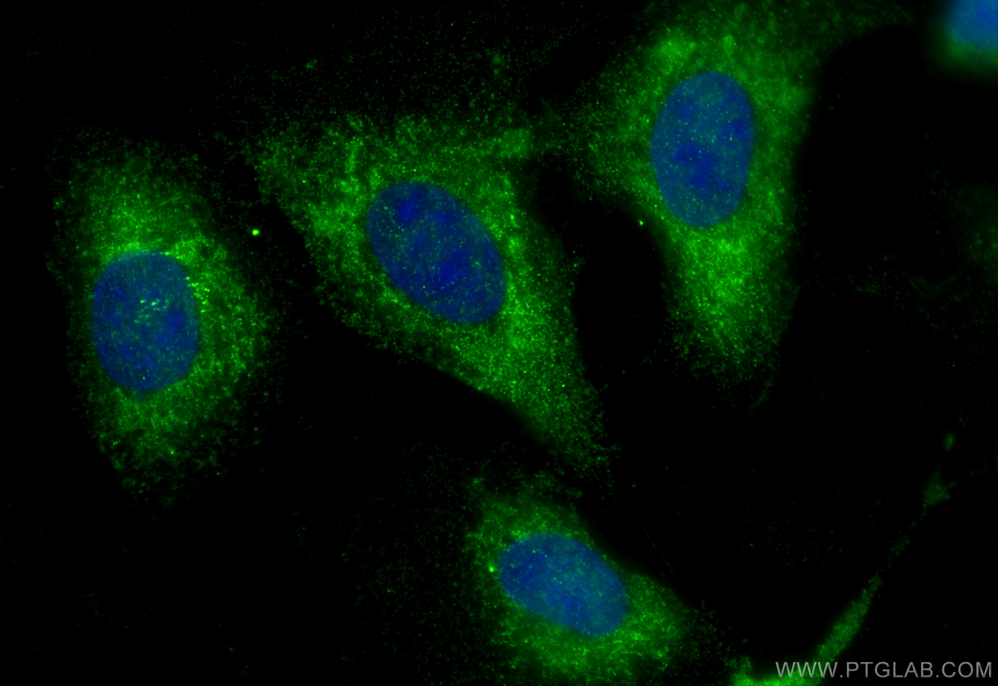 Immunofluorescence (IF) / fluorescent staining of U2OS cells using BMPR1A Polyclonal antibody (12702-1-AP)
