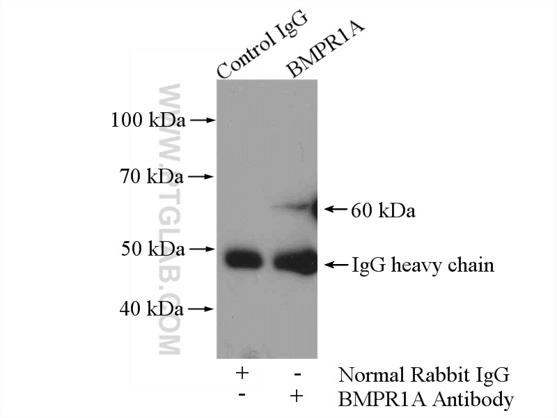 Immunoprecipitation (IP) experiment of HEK-293 cells using BMPR1A Polyclonal antibody (12702-1-AP)