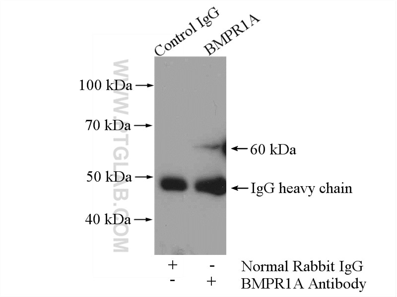 IP experiment of HEK-293 using 12702-1-AP