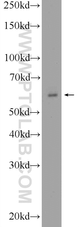 Western Blot (WB) analysis of HEK-293 cells using BMPR1A Polyclonal antibody (12702-1-AP)