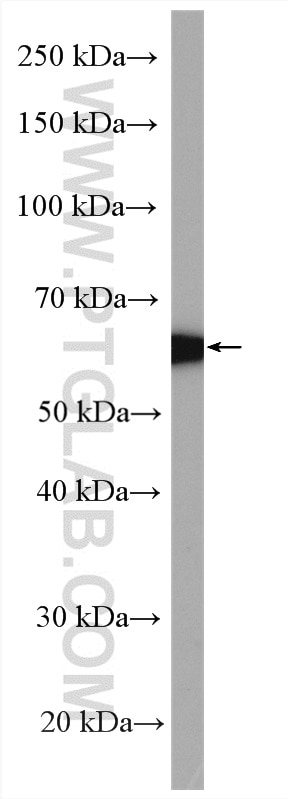 Western Blot (WB) analysis of mouse liver tissue using BMPR1A Polyclonal antibody (12702-1-AP)