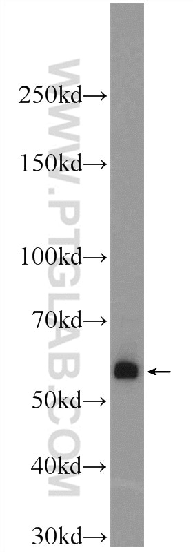 Western Blot (WB) analysis of human skeletal muscle tissue using BMPR1A Polyclonal antibody (12702-1-AP)