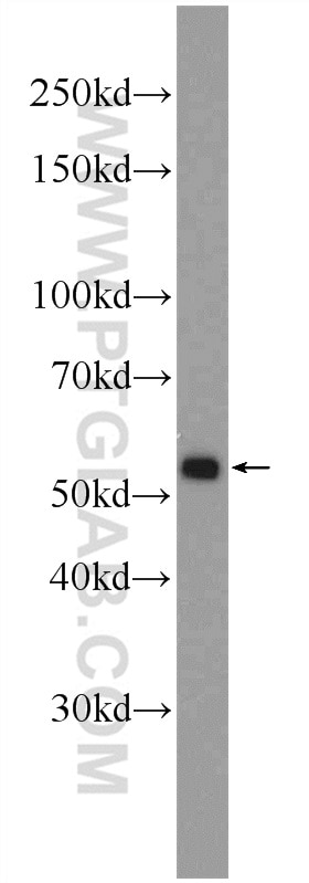 Western Blot (WB) analysis of human heart tissue using BMPR1A Polyclonal antibody (12702-1-AP)