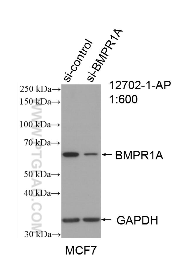 Western Blot (WB) analysis of MCF-7 cells using BMPR1A Polyclonal antibody (12702-1-AP)
