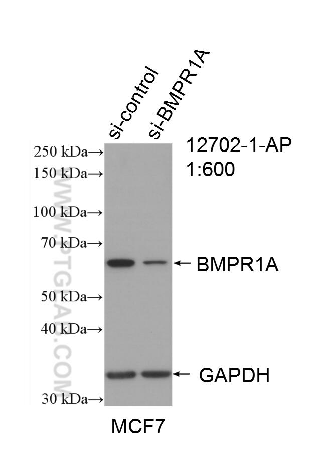 WB analysis of MCF-7 using 12702-1-AP