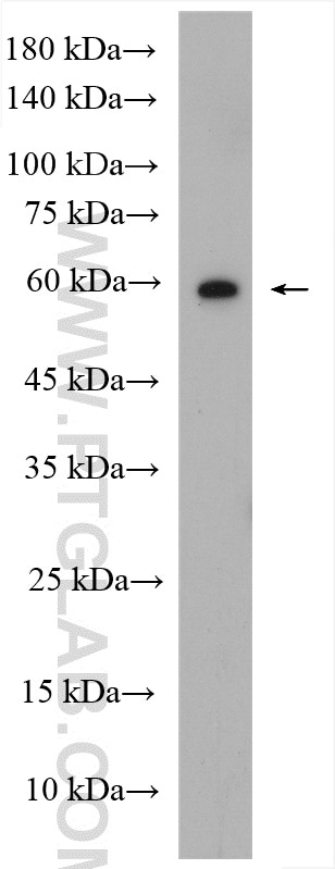 Western Blot (WB) analysis of K-562 cells using BMPR1A Polyclonal antibody (12702-1-AP)