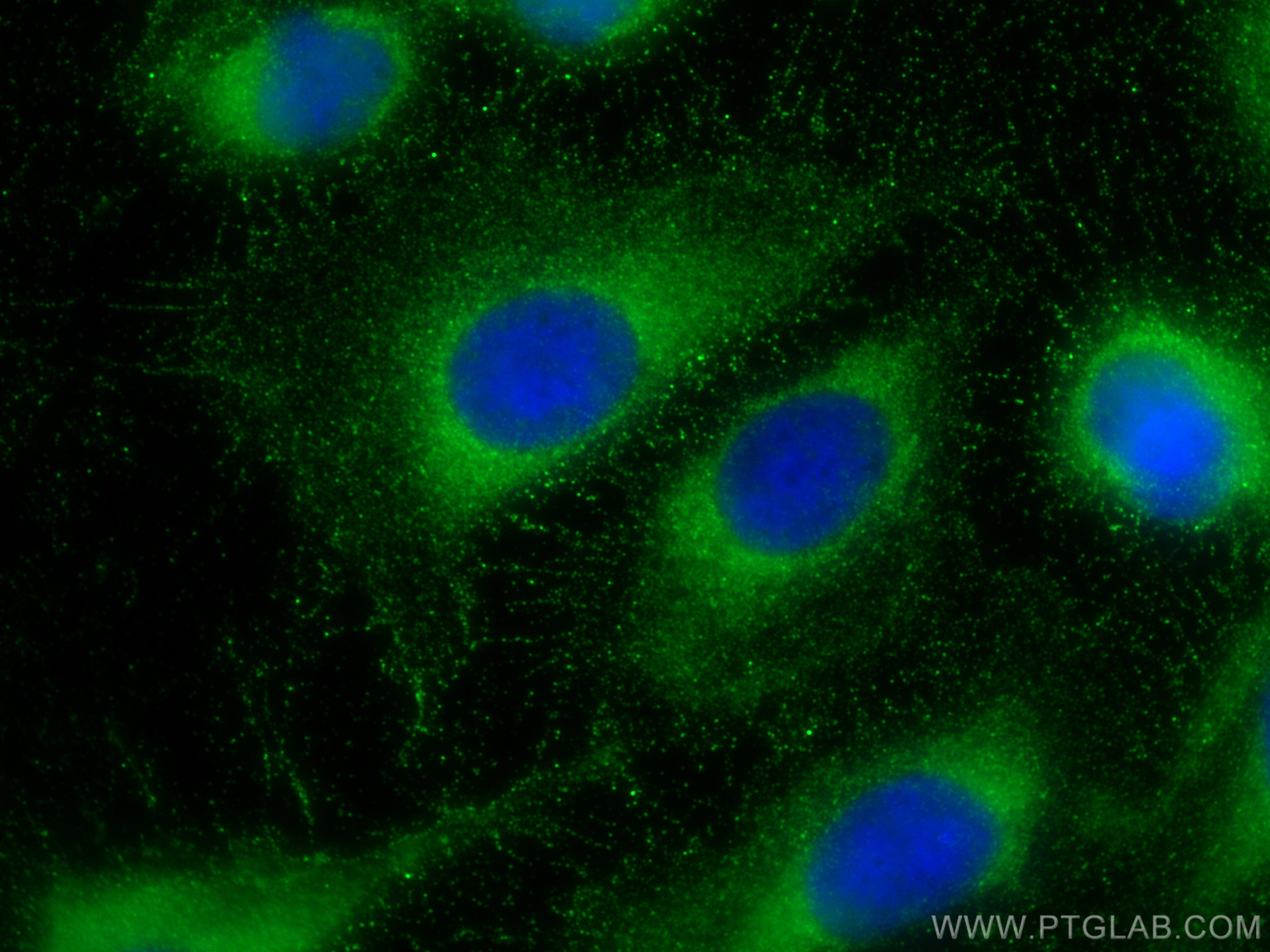 Immunofluorescence (IF) / fluorescent staining of U2OS cells using BMPR1A Polyclonal antibody (30608-1-AP)