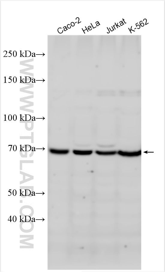 Western Blot (WB) analysis of various lysates using BMPR1A Polyclonal antibody (30608-1-AP)