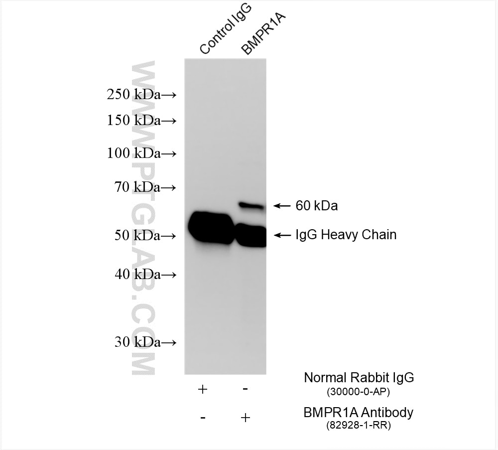 IP experiment of HEK-293 using 82928-1-RR