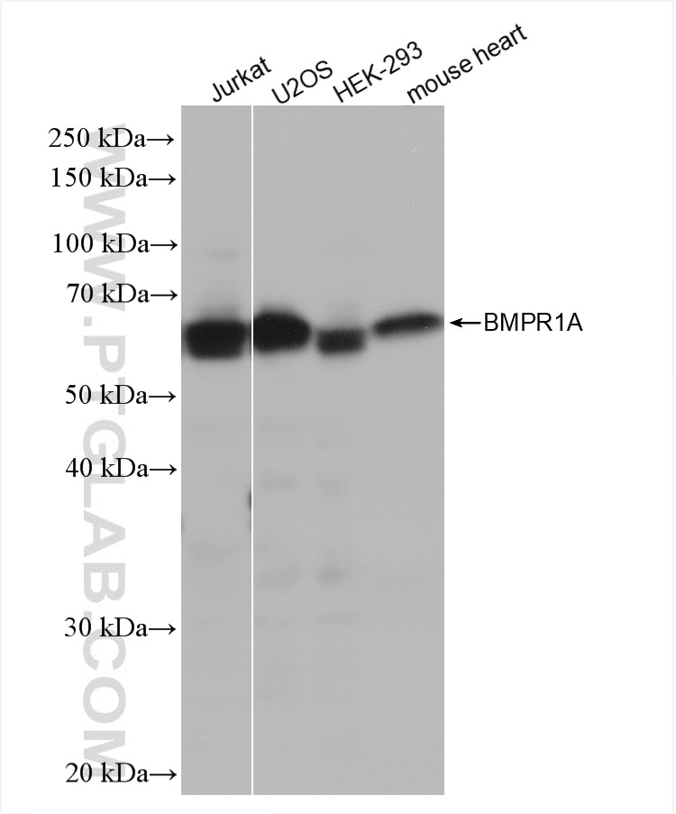 WB analysis using 82928-1-RR