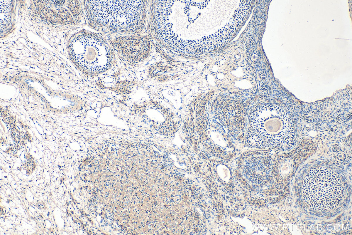 Immunohistochemistry (IHC) staining of rat ovary tissue using BMPR1B Polyclonal antibody (26696-1-AP)