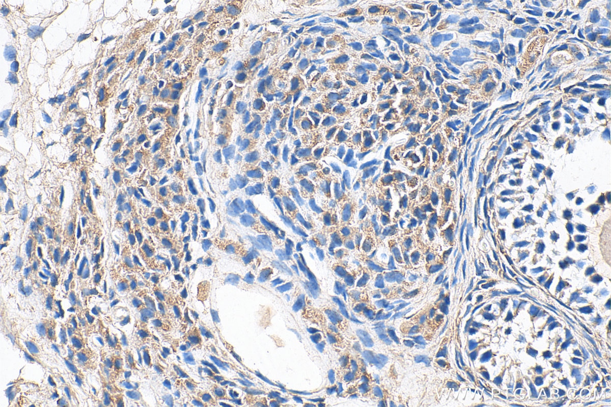 Immunohistochemistry (IHC) staining of rat ovary tissue using BMPR1B Polyclonal antibody (26696-1-AP)