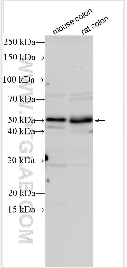 Western Blot (WB) analysis of various lysates using BMPR1B Polyclonal antibody (26696-1-AP)