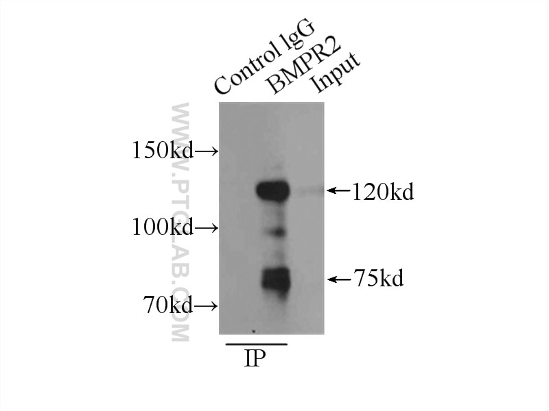 Immunoprecipitation (IP) experiment of mouse brain tissue using BMPR2 Polyclonal antibody (14376-1-AP)