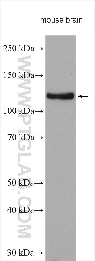 Western Blot (WB) analysis of various lysates using BMPR2 Polyclonal antibody (14376-1-AP)