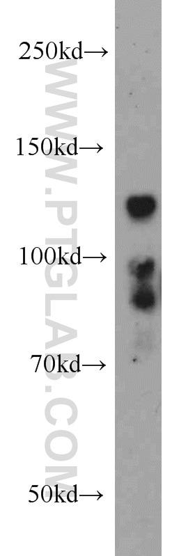 BMPR2 Polyclonal antibody