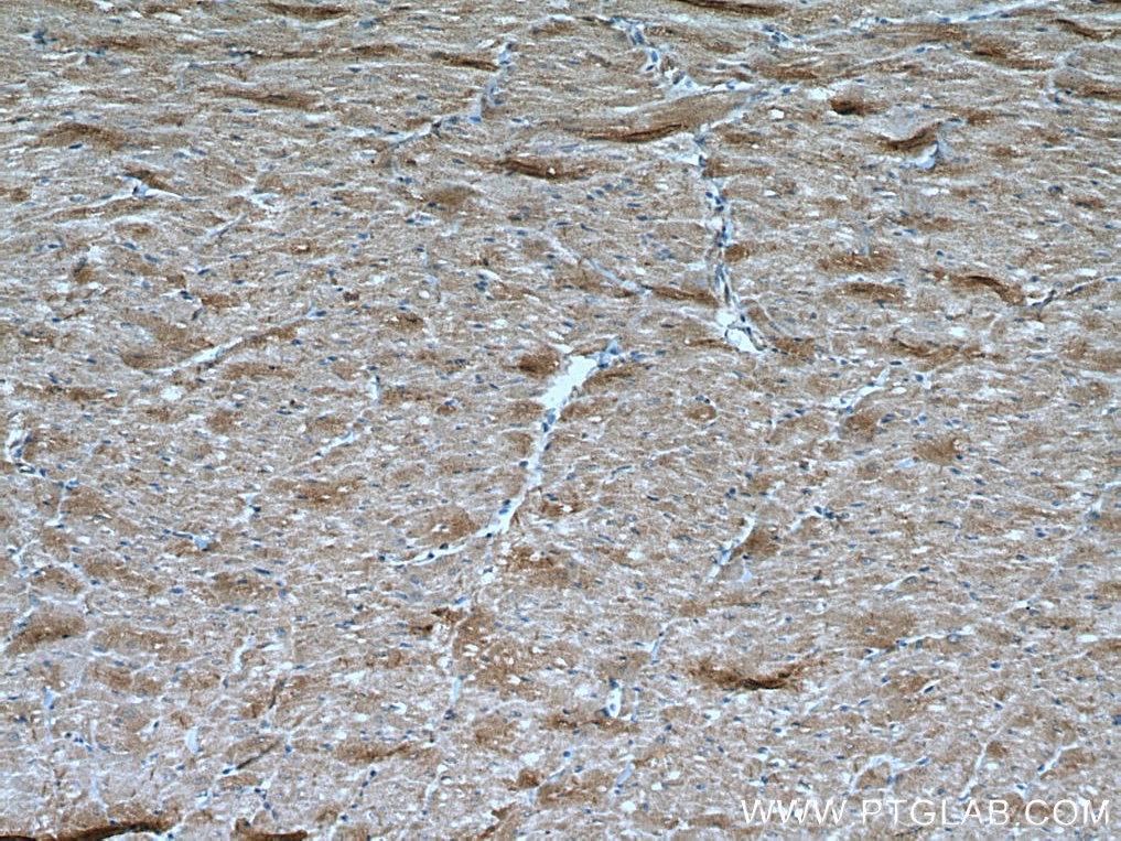 Immunohistochemistry (IHC) staining of human heart tissue using BMPR2 Polyclonal antibody (19087-1-AP)