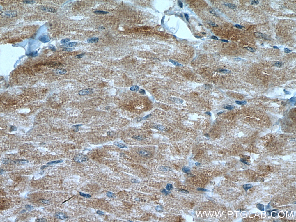 Immunohistochemistry (IHC) staining of human heart tissue using BMPR2 Polyclonal antibody (19087-1-AP)